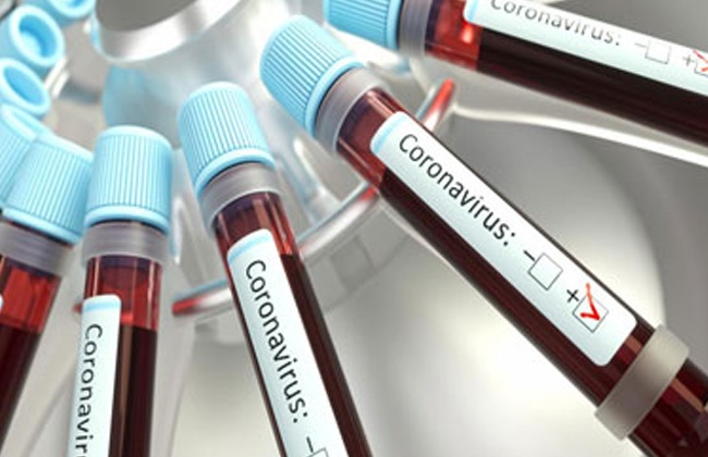 تحليل PCR سلبي شرط دخول مصر لجميع القادمين اعتبارا من اول سبتمبر 2020