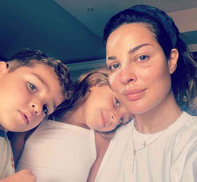 نادين نجيم تنشر صورة لها بعد اصابتها في انفجار مرفأ بيروت